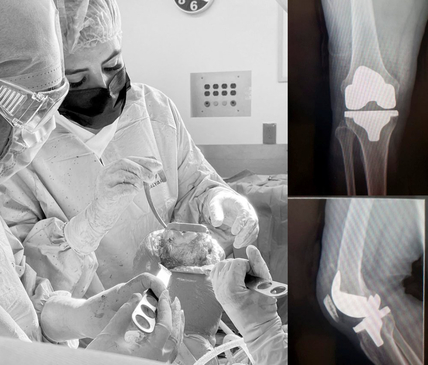 Slider image (4) Dr. Metztli Linette Gomez Espinoza - Orthopedic Clinic